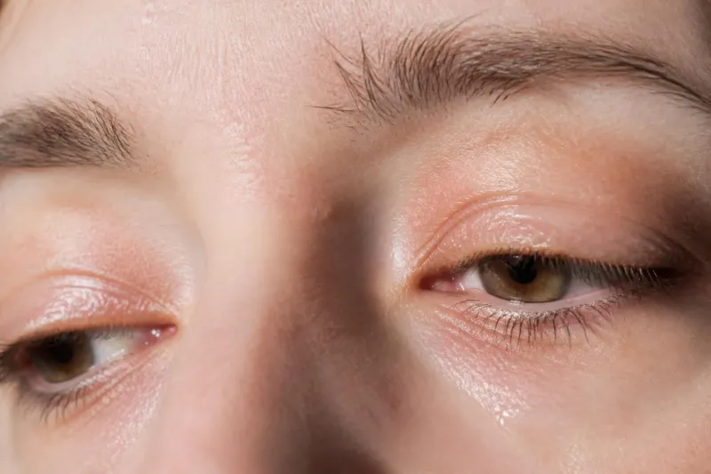 Pourquoi ai-je les paupières grasses ou des croûtes au réveil ?